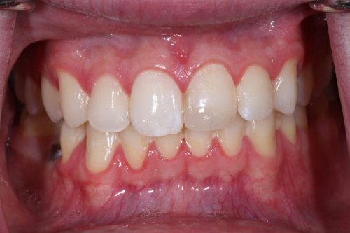 Before Single Central Case 2