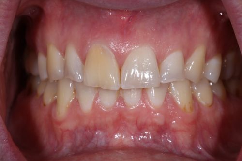 Before Single Central Case 3